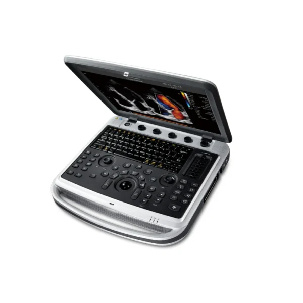Chison SonoBook 6 Portable Ultrasound (1)