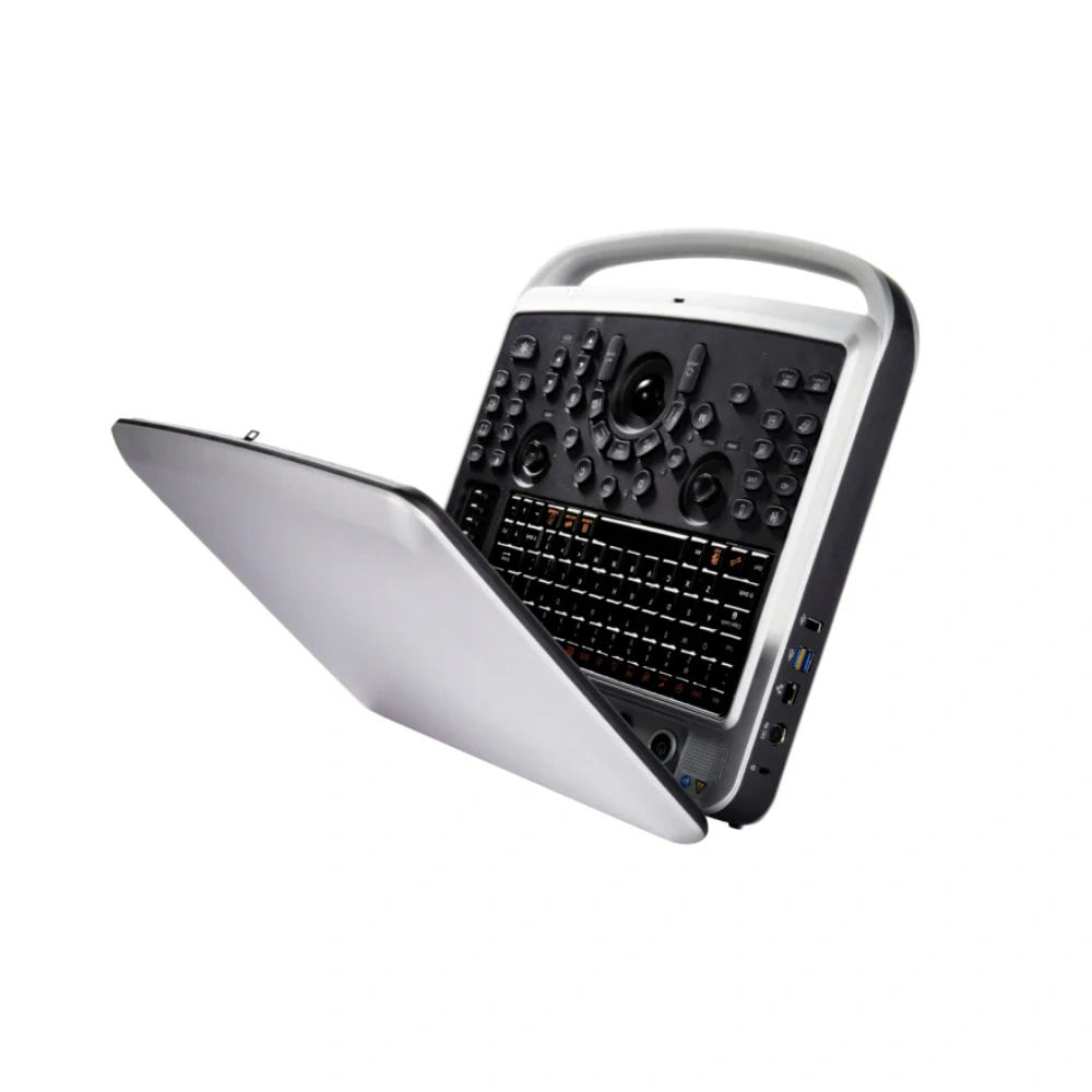 Chison SonoBook 6 Portable Ultrasound (2)