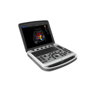 Chison SonoBook 6