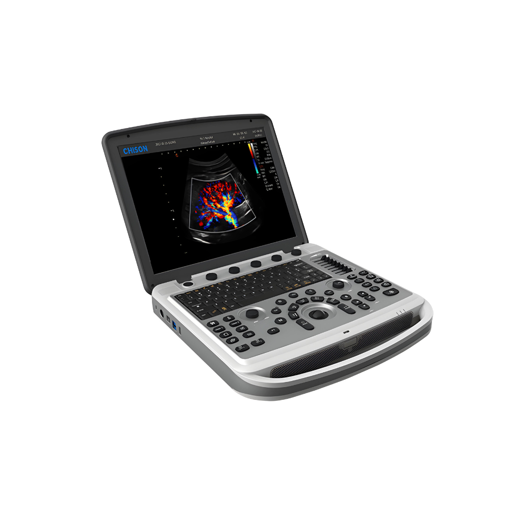 Chison SonoBook 6 Portable Ultrasound Main Image
