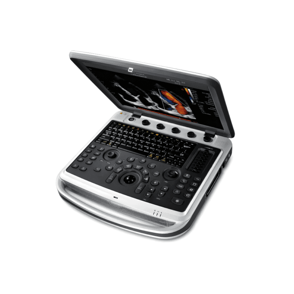 Chison SonoBook 8 Portable Ultrasound (2)