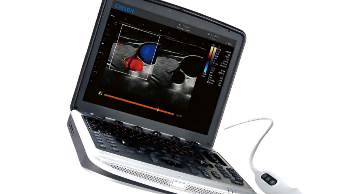 Chison-SonoBook-8-Portable-