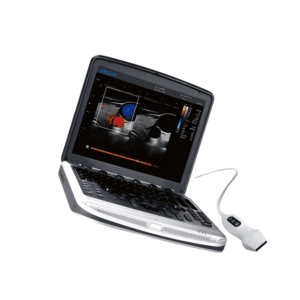 Chison SonoBook 8