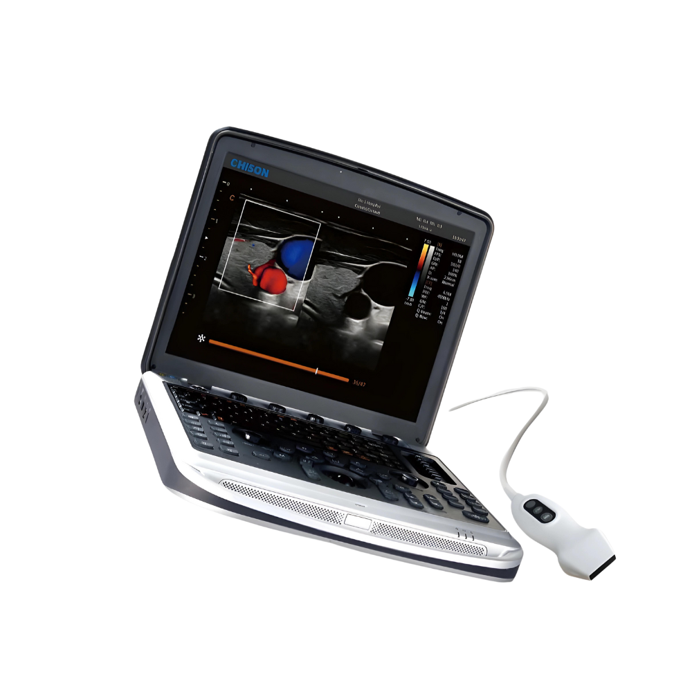 Chison SonoBook 8 Portable Ultrasound Main