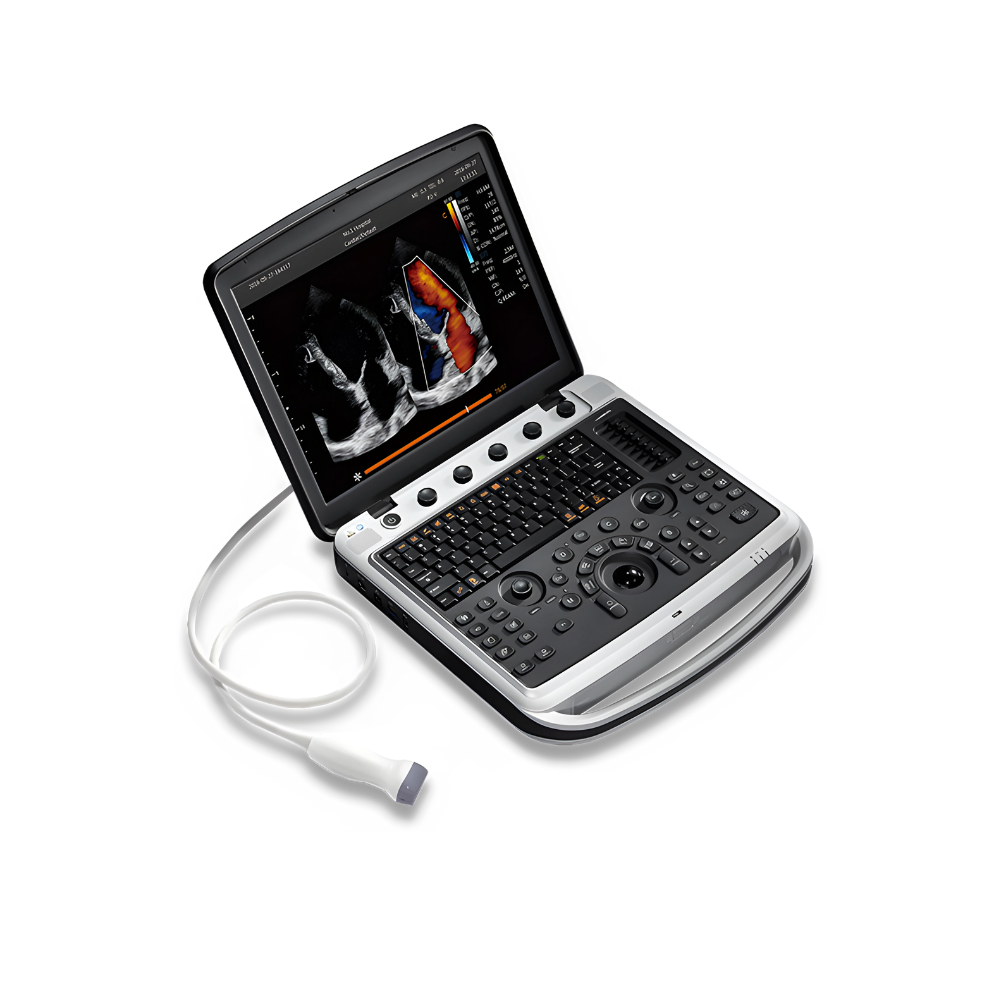 Chison SonoBook 9 Portable Ultrasound (1)