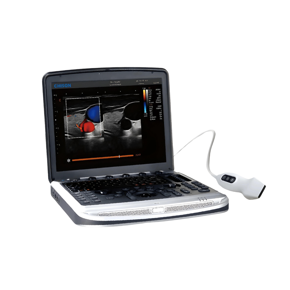 Chison SonoBook 9 Portable Ultrasound (2)