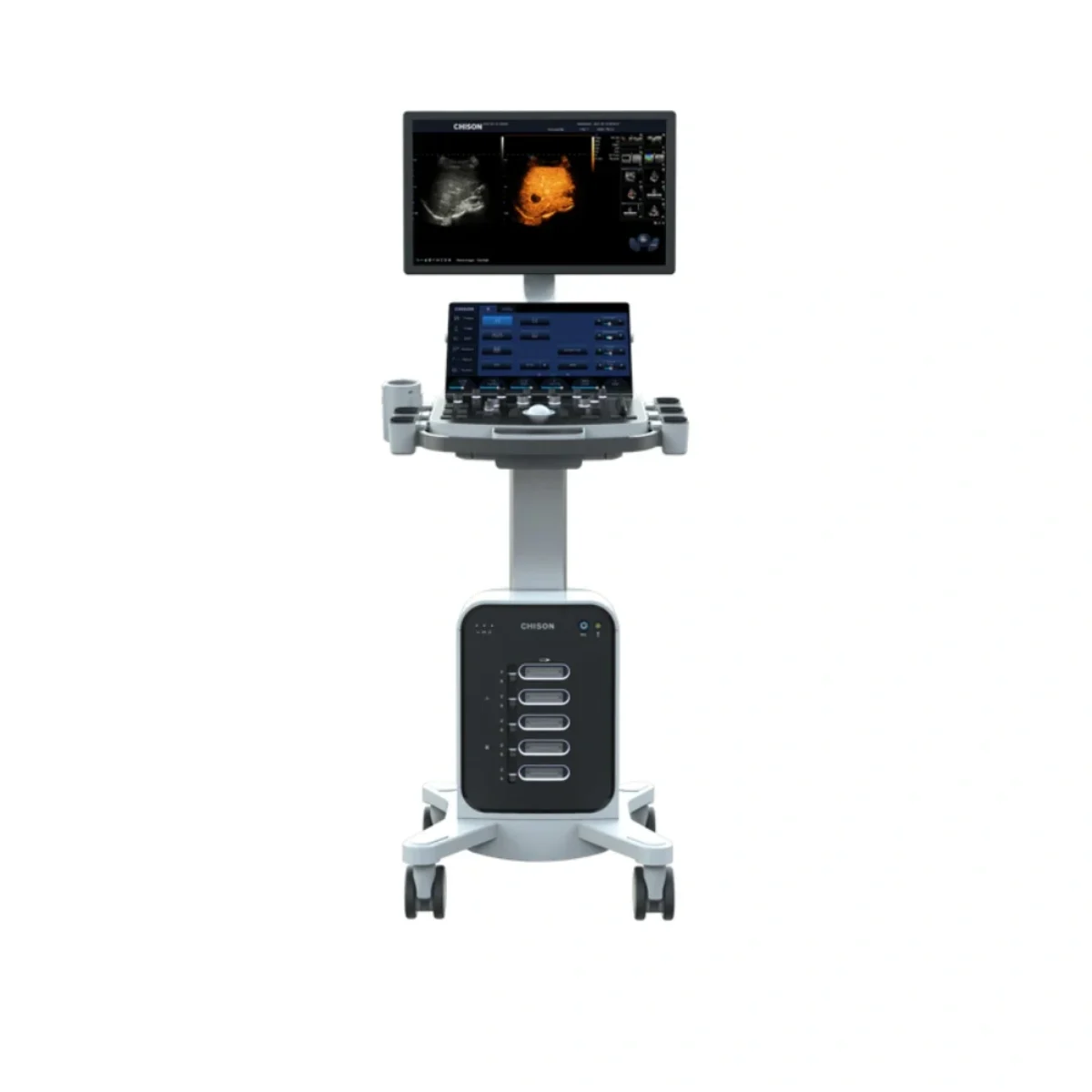 Chison SonoMax 9 Ultrasound | Beats Medical Trading