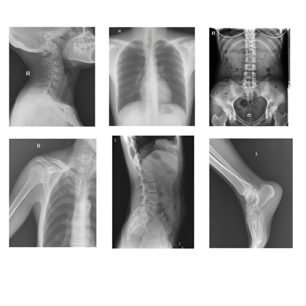 Shoimage Digital Radiography System DDX03