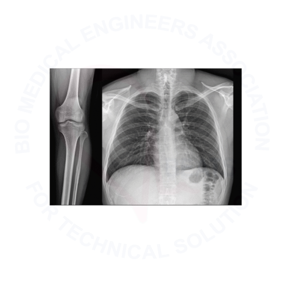 Shoimage Digital Radiography System DDX05