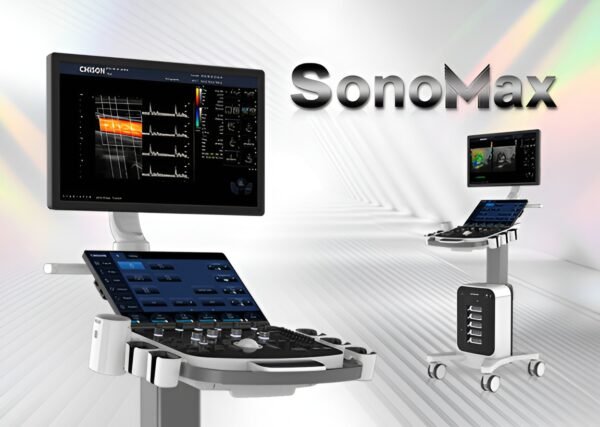 CHISON SonoMax 7 Ultrasound System - Beats Medical